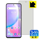 u[CgJbgyzیtB UMIDIGI A11 Pro Max { А