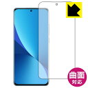 Flexible ShieldyzیtB Xiaomi 12 (Oʂ̂)ywFؑΉz { А