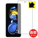 Flexible Shield Matte【 反射低減 】保護フィルム Xiaomi Redmi Note 11T Pro (前面のみ) 日本製 自社製造直販(2)