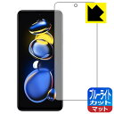 ブルーライトカット【反射低減】保護フィルム Xiaomi Redmi Note 11T Pro 日本製 自社製造直販