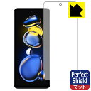 Perfect Shieldy˒ጸzیtB Xiaomi Redmi Note 11T Pro (Oʂ̂) 3Zbg { А