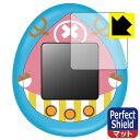 チョッパーっち 用 Perfect Shield【 反射低減 】保護フィルム (3枚セット) 日本製 自社製造直販