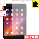 LYȏCیtB Xiaomi Mi Pad 3 { А