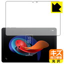 キズ自己修復保護フィルム TCL TAB 10 Gen 2 (8496G1) 日本製 自社製造直販(2)
