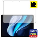 Perfect Shield Plusy˒ጸzیtB vivo Pad3 Pro (ʗp) { А