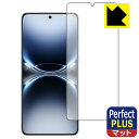 PDA工房で買える「Perfect Shield Plus【 反射低減 】保護フィルム vivo X200 Ultra 【 指紋認証対応 】 日本製 自社製造直販」の画像です。価格は998円になります。