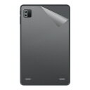 スキンシール VANKYO MatrixPad S8X 【 透明・すりガラス調 】 日本製 自社製造直販
