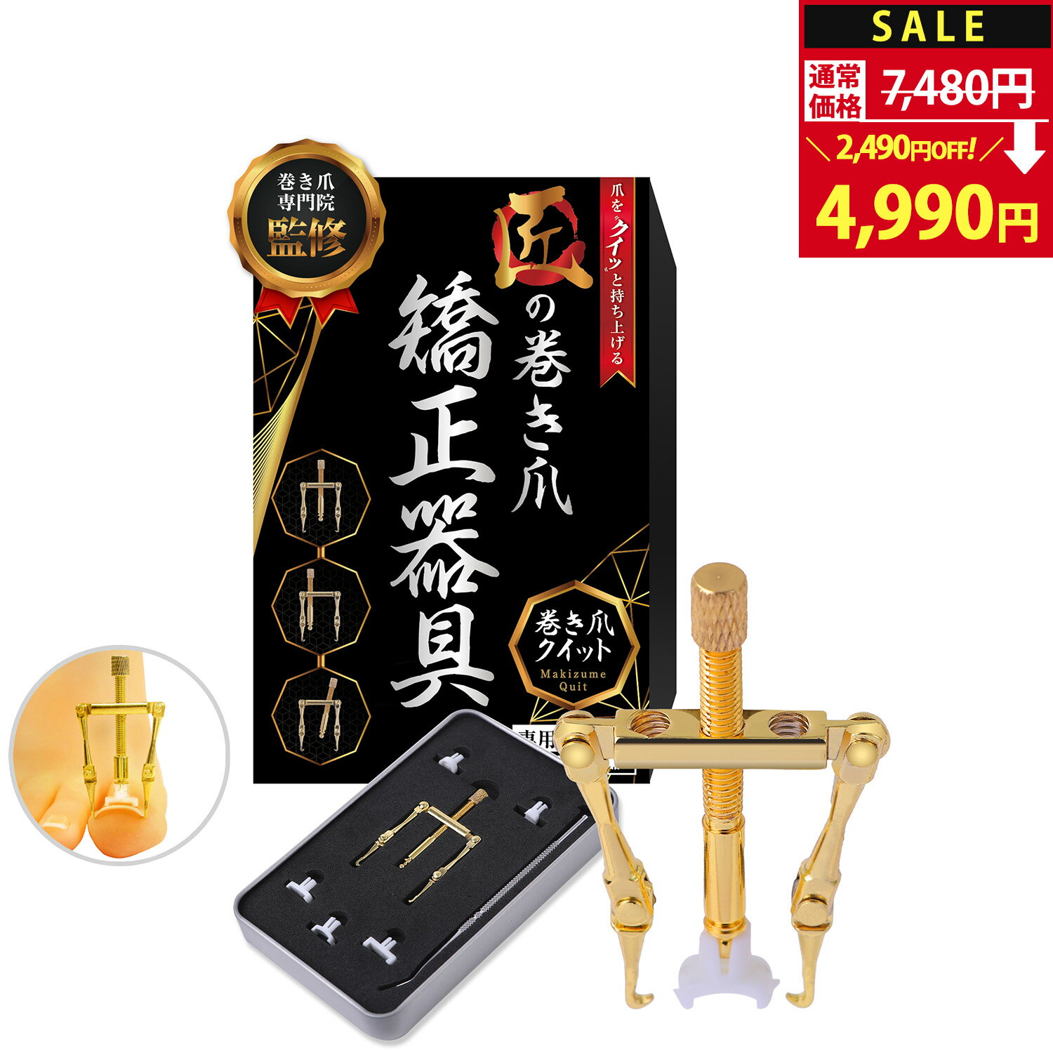 【SALE：7,480円→4,990円！】 巻き爪クイット 巻き爪 【巻き爪専門院 院長監修】 まきずめ まきづめ 矯正 巻爪 まきつめ 巻き爪ケア 巻き爪対策 自分で 治療 矯正 陥入爪 クリップ ワイヤー [専用ケース＆専用ゾンデ＆カラー説明書付属]【90日間全額返金交換】