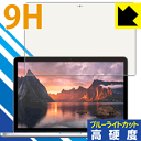 9Hdxyu[CgJbgzیtB MacBook Pro 13C`(2015Nf) { А