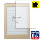 Perfect Shield fW^m[g Freno (t[m) 3Zbg { А