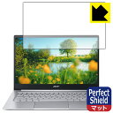 Perfect Shield Acer Swift 3 (SF314-59-H58UV[Y) { А