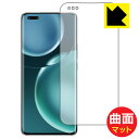 Flexible Shield Mattey˒ጸzیtB Honor Magic4 Pro (ʗp) { А