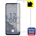 PDAH[ Nokia X30 5GΉ PerfectShield ی tB [ʗp] [wFؑΉ] ˒ጸ hw { А