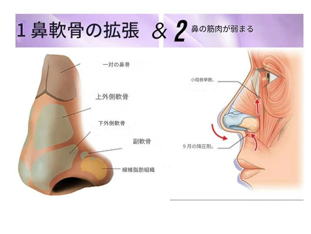 ピースセレクトの鼻専用美顔器 鼻 高鼻矯正 ライン 鼻クリップ 鼻プチ 鼻矯正 美鼻 ノーズアップピン 鼻高 鼻筋美容 コスメ 香水 超音波美顔器 スチーマー 美顔器｜アングル2