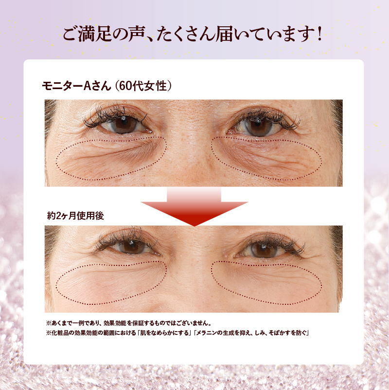 【クーポンで200円OFF★4/17 9:59まで】【薬用アイマール】気になる目元 目袋 たるみ 小ジワ 黒ずみ 目下の悩み 目元明るく アイクリーム 母の日 2