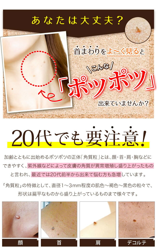 イポケアEX 18ml 【2個セット】角質ケア美容液 ★ いぼ取り 除去 首 肩 顔 デコルテ イボ ポツポツ 角質粒 イボケア ( ヨクイニン バチルス発酵液 ウワウルシ葉エキス ) 送料無料 / イボ デコルテ 首 きれい 除去 ポツポツ 首元 かんたん 塗るだけ plus-cherie-10037687 Plus Cherie 楽天市場店 サンプル画像3
