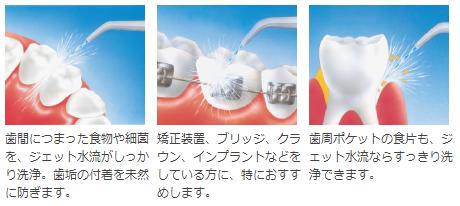 Conair（コンエア）インタープラークデンタル・ウォータージェットWJ6R　1台　送料無料　歯間 洗浄 清掃 水 手軽にすっきり歯周病・口臭対策　歯間ジェット 洗浄 口臭防止 歯垢除去 ウォーターピック