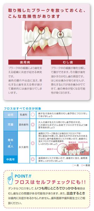 GCジーシ　ルシェロフロス30m　ミントワックス　ピンク　1個　メール便6個までOK！