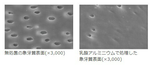 NEW リカル センシティブ(フッ素1450ppm)　70g　1本　小型便5本まで