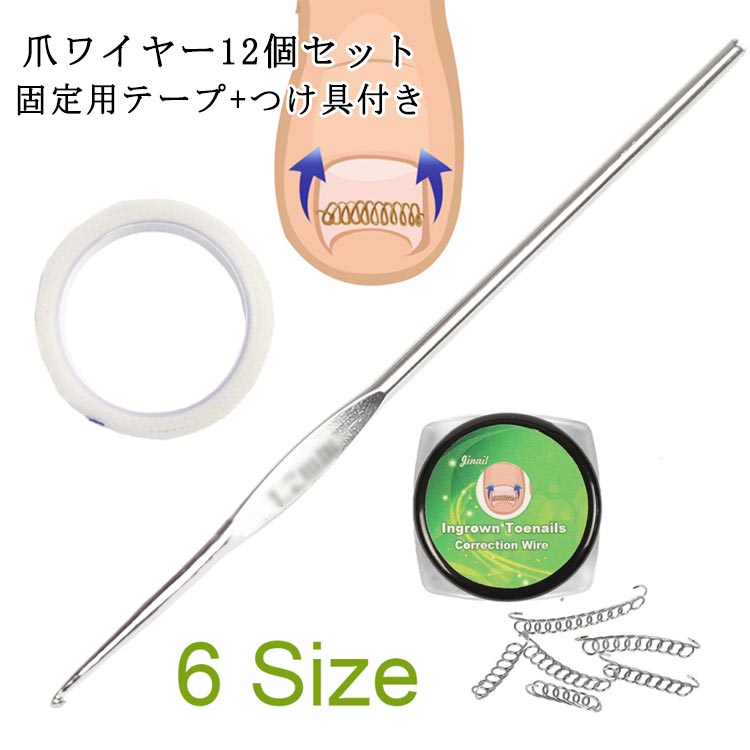【爪ワイヤー12個セット】【固定用テープ+つけ具付き】自分で巻き爪のセルフ矯正!痛い巻き爪のお悩みに加工不要の巻き爪・陥入爪の矯正器具ですぐに使えます。普通・軽度巻き爪・中等巻き爪・重度巻き爪・片側巻き爪など、すべてのタイプの巻き爪に使用可能。サイズ爪ワイヤー12個セットサイズについての説明【セットの内容】矯正チエーン:2組セット(1組6本、共12本) 固定用テープ:1巻 つけ具:1本 【矯正チエーンのサイズ】12-15mm x 2本 14-17mm x 2本 16-20mm x 2本 18-22mm x 2本 20-24mm x 2本 22-26mm x 2本 【サイズ選択の目安】標準サイズ:16mm 男性(足の大きめの方):14mm/16mm 女性(足の小さめの方):16mm/18mm ※実際の爪表面の長さを参考にサイズ選定してください。迷った時は小さめが無難です※疼痛が片側の場合は小さめのサイズを選、ぶの無難です(片側に寄せで使用できます)※爪が厚い場合や変形が強い場合は小さめのサイズ選定が良いです(外側で急激に折れ曲 がっている爪を含む)※形状的には16mmサイズが標準的で使いやすいです。※各サイズで若干形状(波形状の角度)が変化します。素材ステンレスなど色固定用テープ+つけ具付き備考▼商品の色は、撮影時の光や、お客様のモニターの色具合などにより、実際の商品と異なる場合がございます。あらかじめ、ご了承ください。▼生地の特性上、やや匂いが強く感じられるものもございます。数日のご使用や陰干しなどで気になる匂いはほとんど感じられなくなります。▼同じ商品でも生産時期により形やサイズ、カラーに多少の誤差が生じる場合もございます。▼他店舗でも在庫を共有して販売をしている為、受注後欠品となる場合もございます。予め、ご了承お願い申し上げます。テーピング 矯正器具 爪ワイヤー 矯正
