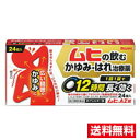 ☆メール便・送料無料☆【第2類医薬品】ムヒAZ錠 24錠 (セルフメディケーション税制対象) 代引き不可