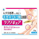 ●メール便・送料無料●数量限定!【第2類医薬品】ケアノキュア 20g 2個セット(セルフメディケーション税制対象)代引き不可