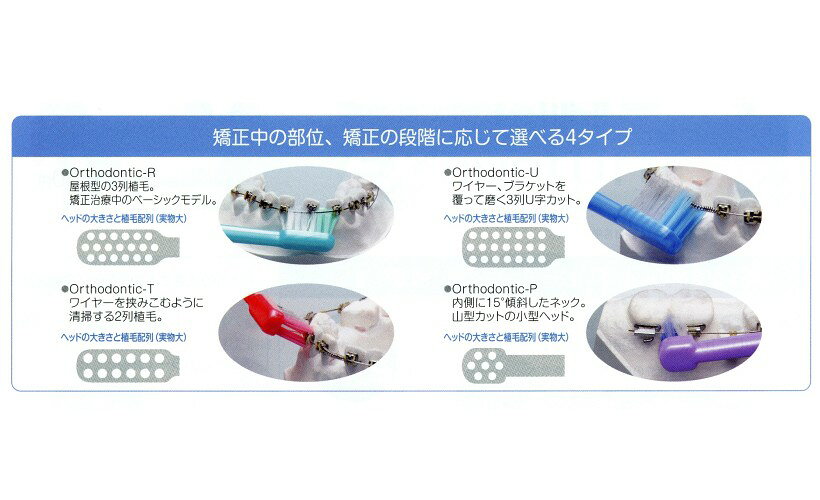 �ڥ᡼��������̵�����ۥ饤���� ���륽�ɥ�ƥ��å� (Orthodontic) ���֥饷 DENT.EX Orthodontic��12�ܡ������ס�-R/-U/-T/-P���������ɥ�ƥ��å�