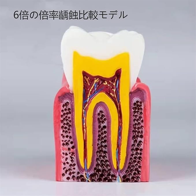 ハヤブサ1の歯科歯モデ モデル歯 モデル 歯 キットある6倍 自由研究 経口モデル 虫歯モデル 6倍 歯列矯正歯医者 歯科モデル患者説明用 模型｜アングル3