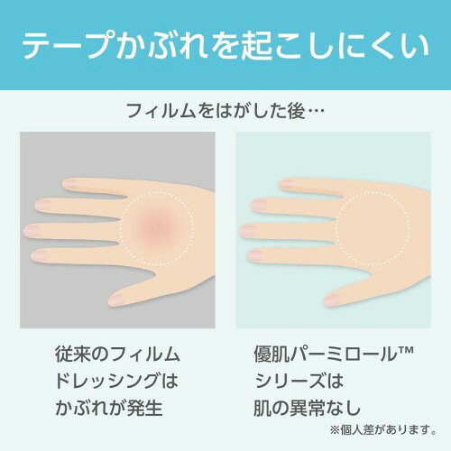 ニトムズ 優肌パーミロールLite 肌にやさしい かぶれにくい防水フィルム 極薄タイ...