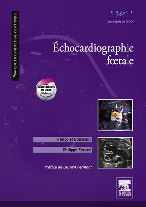 Echocardiographie f?tale【電子書籍】[ Philippe P?zard ]