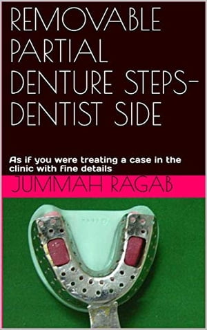 REMOVABLE PARTIAL DENTURE STEPS-DENTIST SIDE As if you were treating a case in the clinic with fine details【電子書籍】[ gumma ragab ]