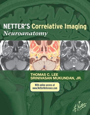 Netter’s Correlative Imaging: Neuroanatomy: with NetterReference.com Access - INK