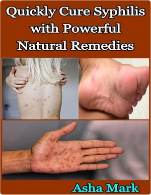 Quickly Cure Syphilis with Powerful Natural Remedies