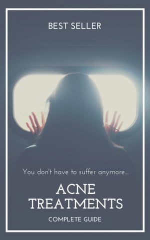 Acne Treatments