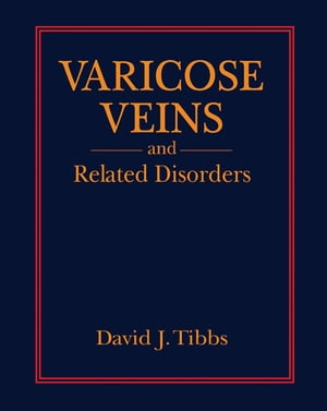 Varicose Veins and Related Disorders