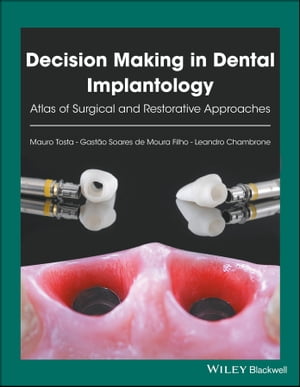 Decision Making in Dental Implantology