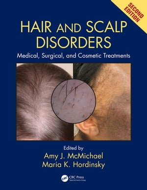 Hair and Scalp Disorders Medical, Surgical, and Cosmetic Treatments, Second Edition【電子書籍】