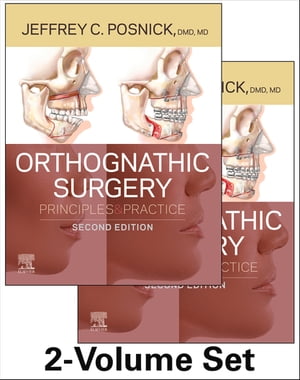 Orthognathic Surgery - 2 Volume Set