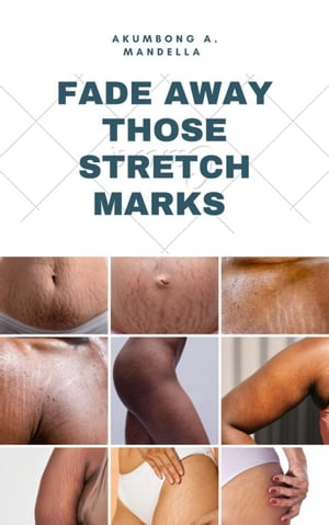 FADE AWAY THOSE STRETCH MARKS Are you tired of those ugly stretch marks on your body? Worry not because this ebook will give you all the step by step guide on fading them away.【電子書籍】[ Akumbong A Mandella ]