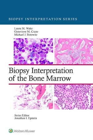 Biopsy Interpretation of the Bone Marrow【電子書籍】[ Laura Wake ]