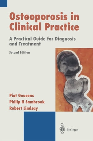 Osteoporosis in Clinical Practice A Practical Guide for Diagnosis and Treatment