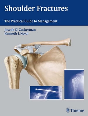 Shoulder Fractures The Practical Guide to ManagementŻҽҡ