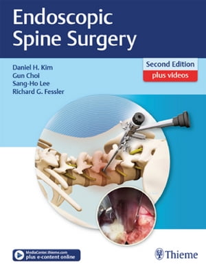 Endoscopic Spine Surgery【電子書籍】 1
