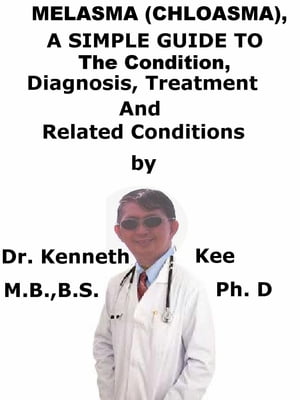 Melasma, (Chloasma) A Simple Guide To The Condition, Diagnosis, Treatment And Related Conditions【電子書籍】 Kenneth Kee