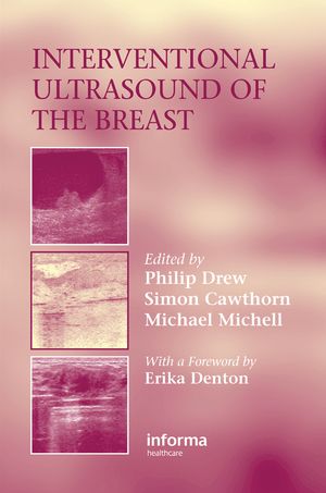 Interventional Ultrasound of the BreastŻҽҡ