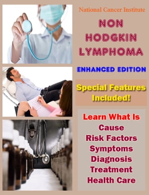 Non-Hodgkin Lymphoma