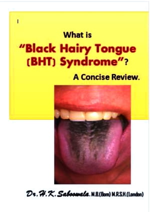 What is “Black Hairy Tongue (BHT) Syndrome”? A Concise Review.