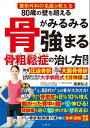 整形外科の名医が教える　80歳の壁を超える　骨がみるみる強まる骨粗鬆症の治し方大全【電子書籍】[ 猪瀬弘之 ]