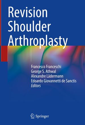 Revision Shoulder Arthroplasty