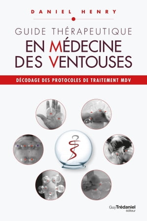 Guide th?rapeutique en m?decine des ventouses - D?codage des protocoles de traitement MDV.